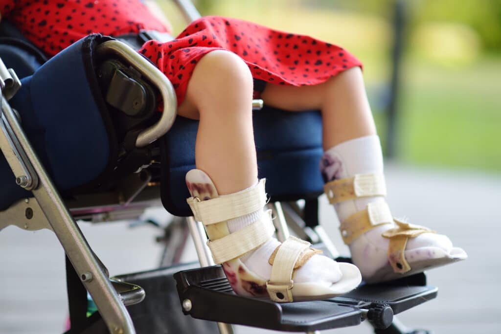 Cuidado a un niño con lesiones al nacer