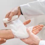 Quemadura grave en USA